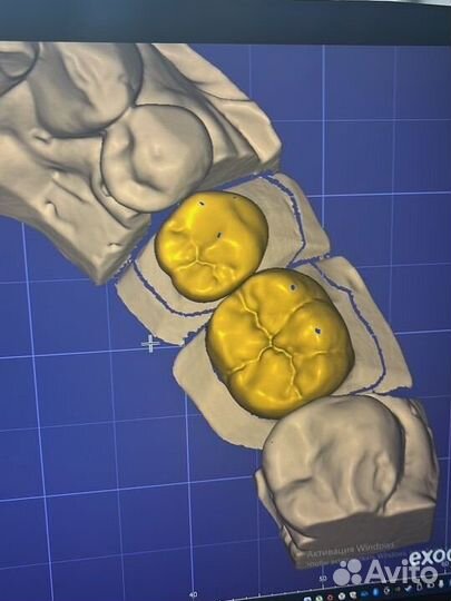 Зубной техник