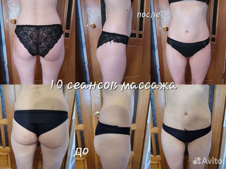 Антицеллюлитный массаж