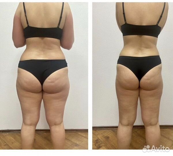 Массаж коррекция фигуры