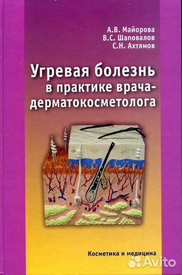 Угревая болеснь в практике врача