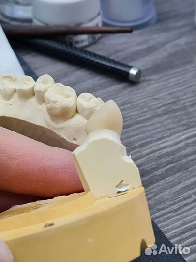 Литьё Emax press