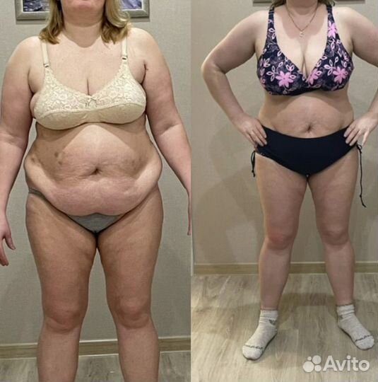 Аппаратный массаж