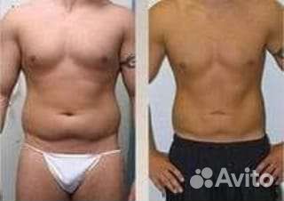 Похудение, удаление лишней жировой прослойки