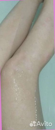 Мазь от псориаза