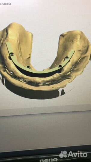 3D моделировка exocad, 3 shape