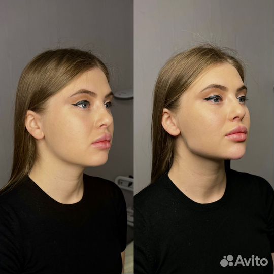 Требуются модели на нити. Косметолог