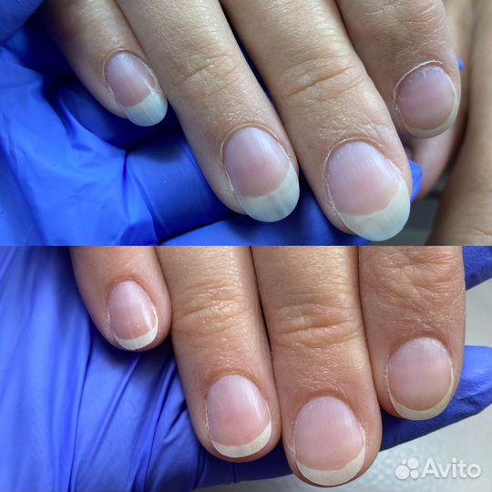 Аппаратный маникюр