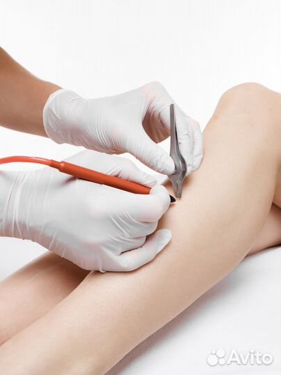 Курсы электроэпиляции в Архангельске