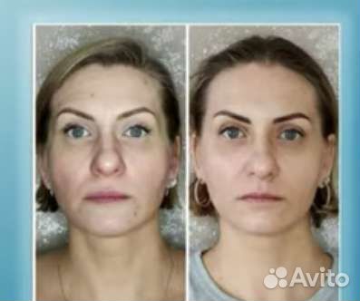 Похудение вместе, Красота и здоровье