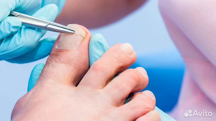 Услуги подолога