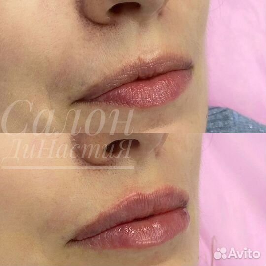 Чистка лица