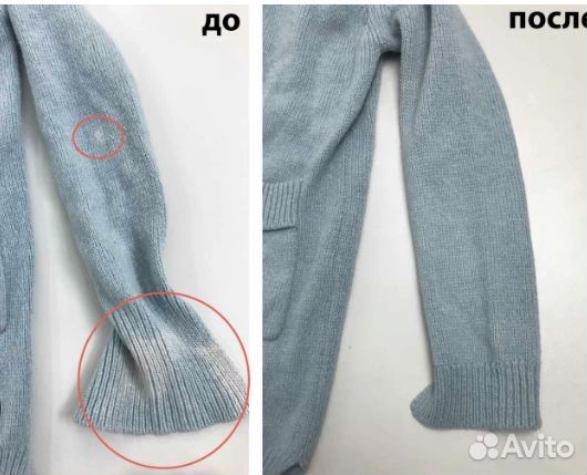 Ремонт трикотажный изделий