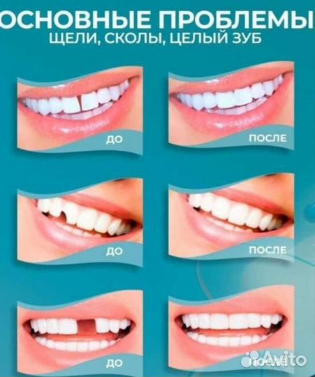 Клей - Гель для зубов