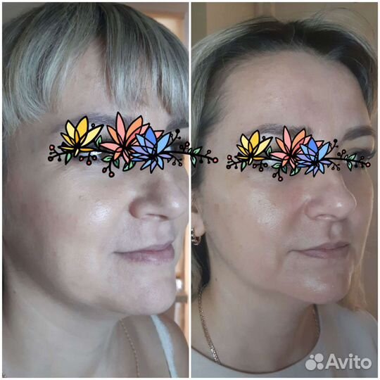 Косметолог, массаж, пилинг, чистка, аппарат массаж