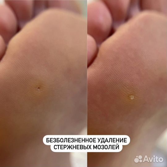 Подолог / Подология