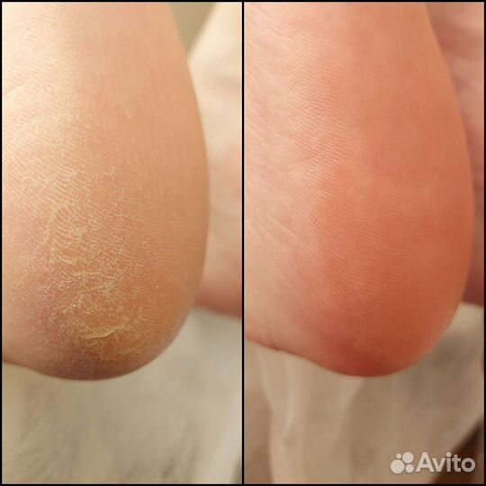 Смарт педикюр, маникюр