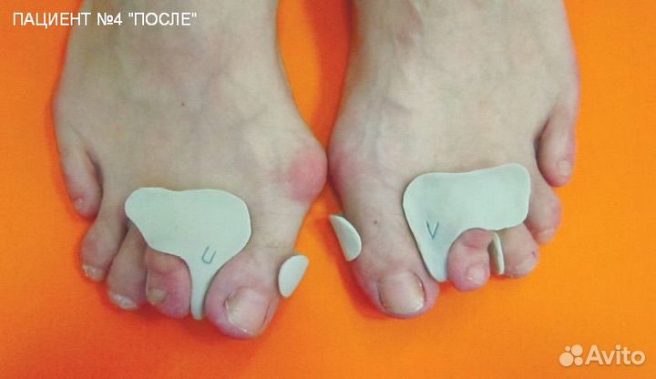 Изготовление индивидуальных отрезов