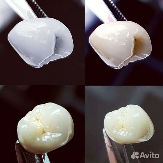 Зубной техник керамист лаборатория