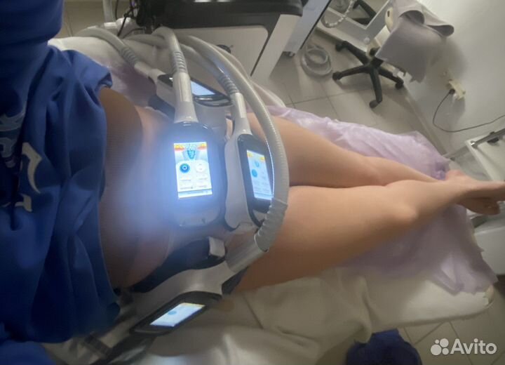 Криолиполиз, емс(emsculpt, хайфем).Мощные аппар