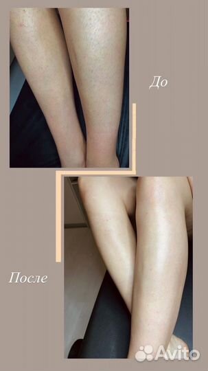 Депиляция восковая, шугаринг