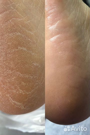 Педикюр smart/kart и Ламинирование Ресниц Inlei