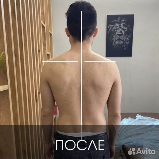 Мануальный терапевт