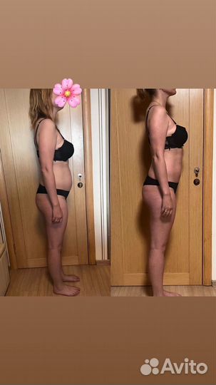 Массаж. LPG массаж.Выезд на дом