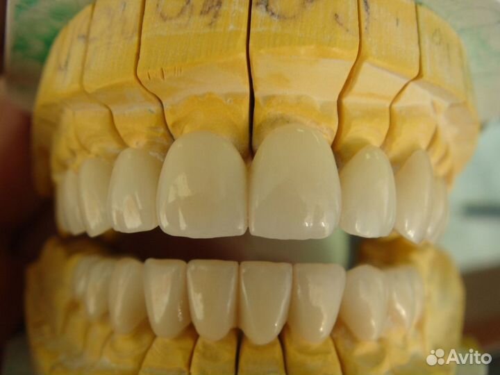 Зубной техник