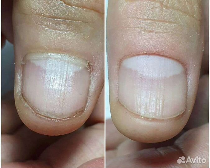 Пилочный Маникюр Японский ВДНХ