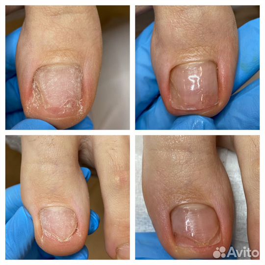 Услуги подолога