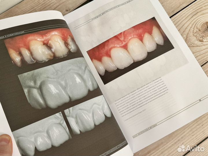 Эстетическая и реставрационная стоматология