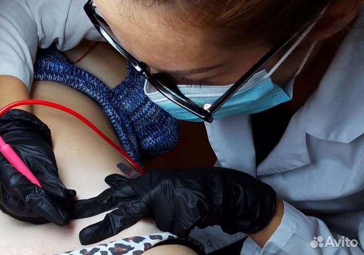 Модели на электро эпиляцию