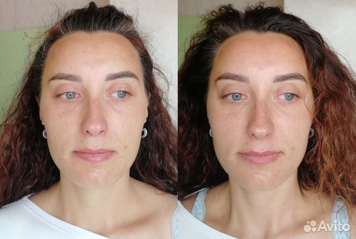 Массаж лица