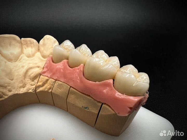 Зуботехнические услуги лаборатории