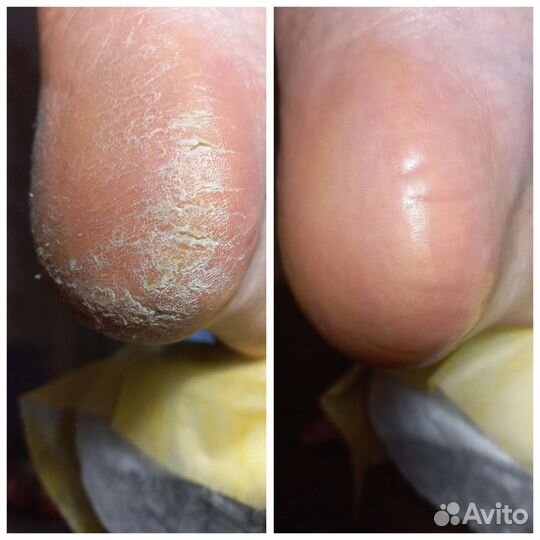 Маникюр педикюр