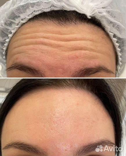 Услуги косметолога