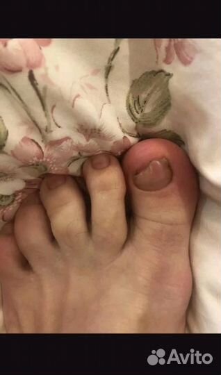 Педикюр подолог