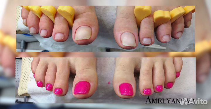 Маникюр педикюр