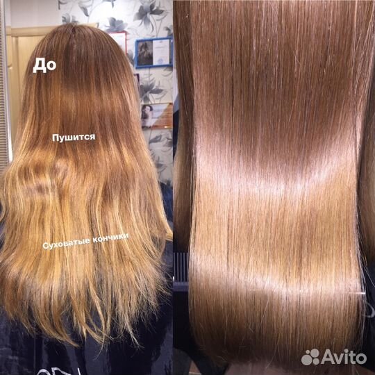 Нанопластика, ботокс, Биксипластия