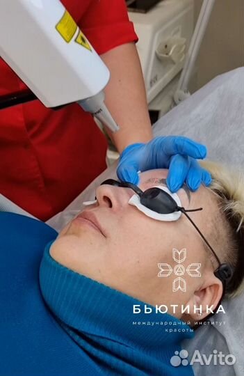 Удаление татуажа лазером