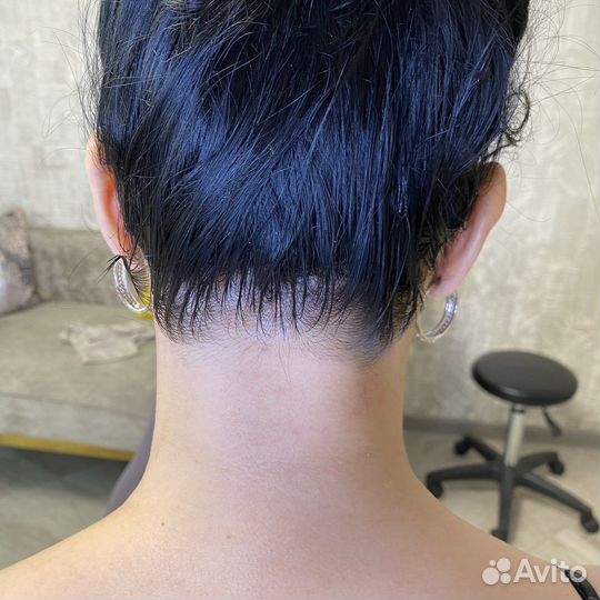 Элос эпиляция