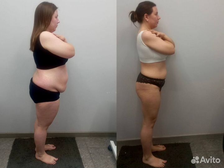 Быстрое похудение лица и тела. Липолитики