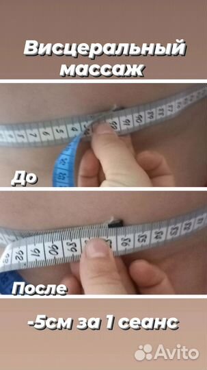 Антицеллюлитный массаж