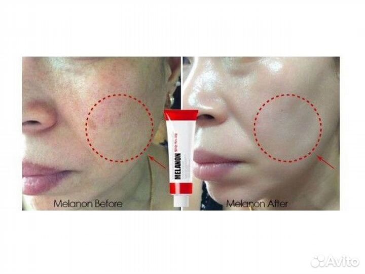 Крем от пигментации Melanon X Drop Gel, 50 мл