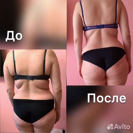Шугаринг депиляция