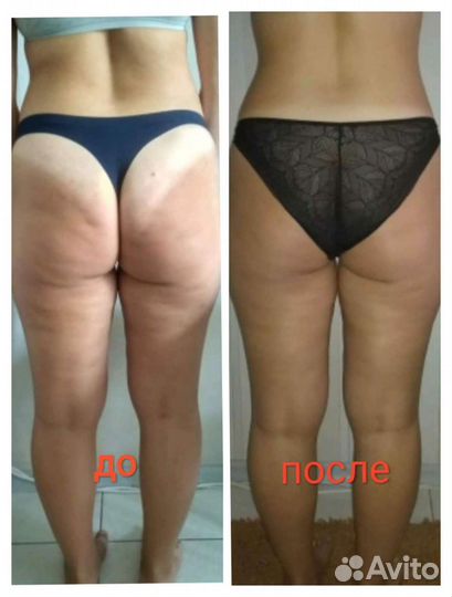 Коррекция фигуры