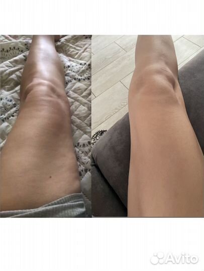 Массажист аппаратный