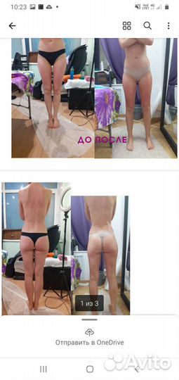 Антицеллюлитный массаж