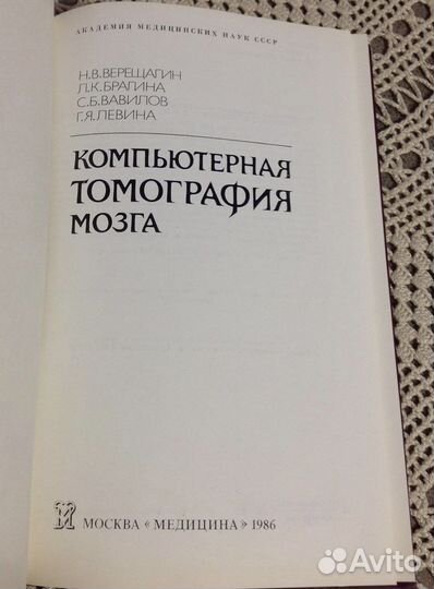 Компьютерная томография мозга, Верещагин