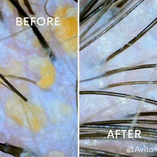 Процедуры для волос